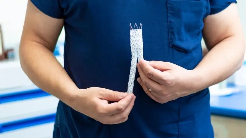 Aort anevrizması girişimsel tedavisi