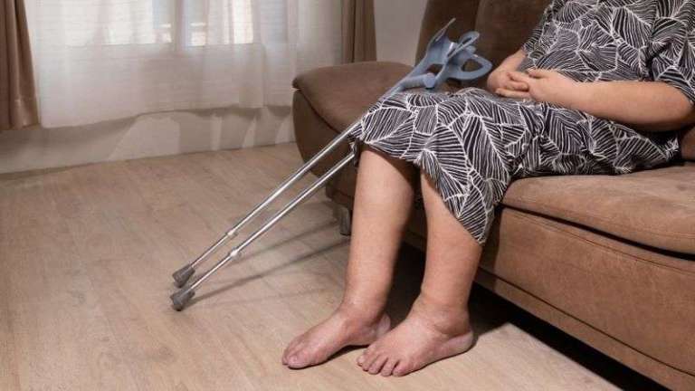 Derin ven trombozu (DVT). Bacak toplardamar tıkanıklığı