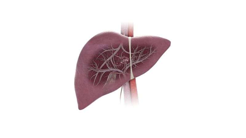 Portal hipertansiyon girişimsel tedavisi